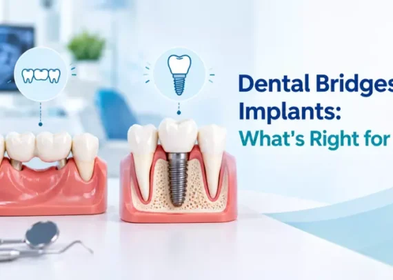 Diagram comparing Dental Bridges vs. Implants for replacing missing teeth